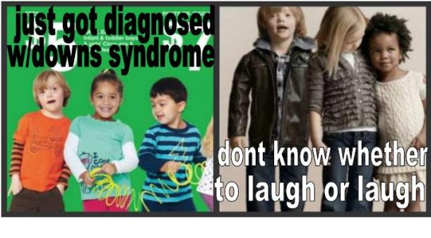 Child Model with Down Syndrome Meme